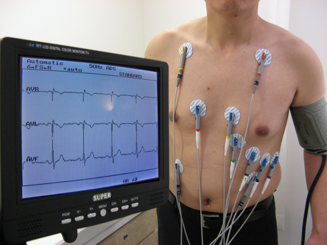 Meditrina ECG